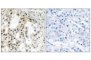 Immunohistochemistry (IHC) image for anti-Eukaryotic Translation Initiation Factor 3, Subunit D (EIF3D) (Internal Region) antibody (ABIN1851320) (EIF3D anticorps  (Internal Region))