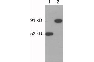 Western blot analysis of His-fusion protein (MW~91 kD) using 1 µg/mL Rabbit Anti-His-tag Polyclonal Antibody (ABIN398410) Lane 1: His-tag fusion protein expressed in E. (His Tag anticorps)