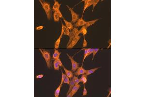 Immunofluorescence analysis of NIH/3T3 cells using PFKL antibody (ABIN7269308) at dilution of 1:100. (PFKL anticorps  (AA 700-780))