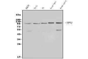 Western blot analysis of TRPV4 using anti-TRPV4 antibody (ABIN7602255).