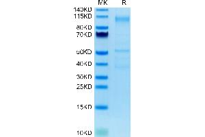 Cynomolgus CDH17 on Tris-Bis PAGE under reduced condition. (LI Cadherin Protein (AA 1-795) (His tag))
