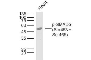 Mouse heart lysates probed with SMAD5 (Ser463 + Ser465) Polyclonal Antibody, Unconjugated  at 1:300 dilution and 4˚C overnight incubation.