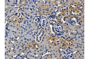 ABIN7097157 and ABIN7101225 at 1/100 staining mouse kidney tissue by IHC-P. (MANBA anticorps)