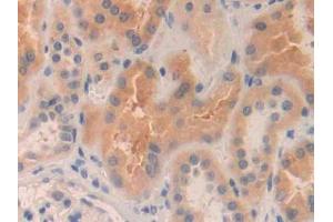DAB staining on IHC-P; Samples: Human Kidney Tissue (MMP24 anticorps  (AA 429-642))