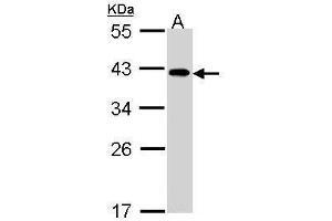 WB Image Sample (30 ug of whole cell lysate) A: A431 , 10% SDS PAGE antibody diluted at 1:1000 (eIF2B beta (Center) anticorps)