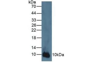 Rabbit Detection antibody from the kit in WB with Positive Control: Human A431 cells. (S100A2 Kit ELISA)