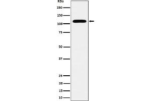 Western blot analysis of SEC24D expression in HeLa cell lysate.