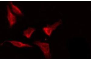 ABIN6276189 staining HeLa by IF/ICC. (OR8G5 anticorps  (Internal Region))