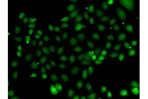 Immunofluorescence analysis of MCF-7 cells using NFYB antibody (ABIN5974397). (NFYB anticorps)