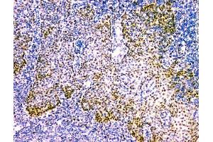 IHC analysis of NFIA using anti-NFIA antibody (ABIN6719349).