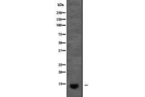 Western blot analysis of KCNE2 expression in Pancreas (Mouse) Tissue Lysate ,The lane on the left is treated with the antigen-specific peptide. (KCNE2 anticorps  (Internal Region))