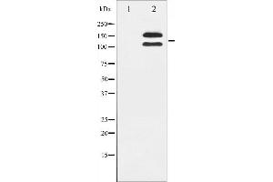 Western blot analysis of c-Kit phosphorylation expression in HeLa whole cell lysates,The lane on the left is treated with the antigen-specific peptide. (KIT anticorps  (pTyr721))