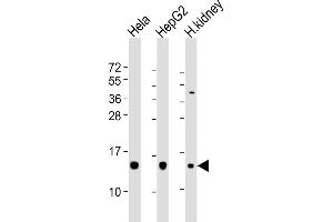 All lanes : Anti-PFN1 Antibody (C-term) at 1:2000 dilution Lane 1: Hela whole cell lysates Lane 2: HepG2 whole cell lysates Lane 3: human kidney lysates Lysates/proteins at 20 μg per lane. (PFN1 anticorps  (C-Term))