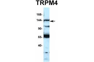 Host:  Rabbit  Target Name:  TRPM4  Sample Type:  Jurkat  Antibody Dilution:  1. (TRPM4 anticorps  (N-Term))
