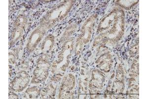 Image no. 1 for anti-Paraneoplastic Antigen MA1 (PNMA1) (AA 62-161) antibody (ABIN598600) (PNMA1 anticorps  (AA 62-161))