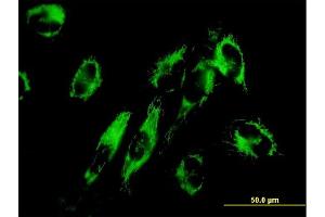 Immunofluorescence of monoclonal antibody to NNT on HepG2 cell. (NNT anticorps  (AA 1-207))