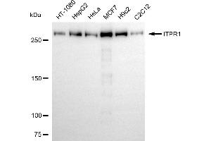 Western blotting analysis using ITPR1 antibody (ABIN7799042).