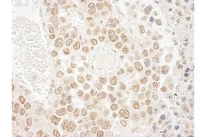 Immunohistochemistry (IHC) image for anti-Denticleless E3 Ubiquitin Protein Ligase Homolog (DTL) (C-Term) antibody (ABIN7448536) (CDT2/RAMP anticorps  (C-Term))