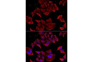 Immunofluorescence analysis of HeLa cells using TCAP antibody. (TCAP anticorps)