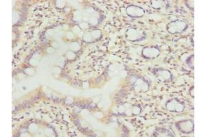 Immunohistochemistry of paraffin-embedded human small intestine tissue using ABIN7158480 at dilution of 1:100 (Uncharacterized Protein C7orf34 (LLCFC1) (AA 29-122) anticorps)