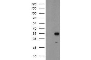 Western Blotting (WB) image for anti-Myeloid Leukemia Factor 1 (MLF1) antibody (ABIN1499494) (MLF1 anticorps)