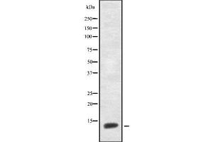 Western blot analysis of CNP-53 using HepG2 whole cell lysates (NPPC anticorps  (Internal Region))