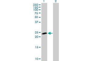 Western Blot analysis of NOP16 expression in transfected 293T cell line by NOP16 MaxPab polyclonal antibody. (NOP16 anticorps  (AA 1-178))