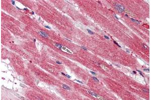 Human Heart (formalin-fixed, paraffin-embedded) stained with S100A4 antibody ABIN337243 at 2. (s100a4 anticorps)