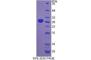 SDS-PAGE analysis of Rat DTNBP1 Protein. (DTNBP1 Protéine)