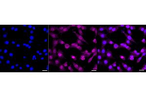 anti-NEDD4 Binding Protein 1 (N4BP1) antibody
