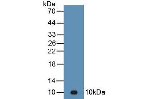 Detection of Recombinant C4b, Mouse using Polyclonal Antibody to Complement C4-B (C4B) (C4B anticorps  (AA 126-366))