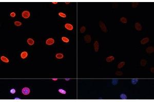 Immunofluorescence analysis of NIH/3T3 cells using Acetyl-Histone H2B-K5 Polyclonal Antibody at dilution of 1:100.