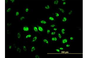 Immunofluorescence of monoclonal antibody to MPG on HeLa cell. (MPG anticorps  (AA 1-90))