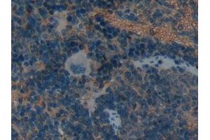 Detection of LIFR in Rat Spleen Tissue using Polyclonal Antibody to Leukemia Inhibitory Factor Receptor (LIFR)