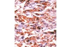 Image no. 1 for anti-Cyclin-Dependent Kinase Inhibitor 1A (p21, Cip1) (CDKN1A) (pSer130) antibody (ABIN358179)