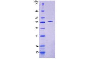 SDS-PAGE (SDS) image for Ecto-NOX Disulfide-Thiol Exchanger 2 (ENOX2) (AA 1-207) protein (His tag) (ABIN6239099)