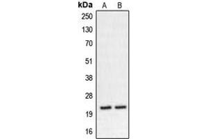 Western blot analysis of CHP2 expression in K562 (A), HT29 (B) whole cell lysates. (Chp2 anticorps  (Center))