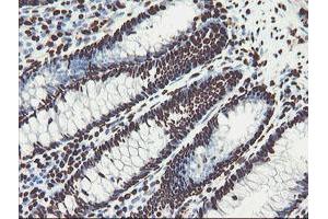 Image no. 16 for anti-Non-POU Domain Containing, Octamer-Binding (NONO) (AA 184-385) antibody (ABIN1491073) (NONO anticorps  (AA 184-385))