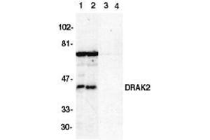 Western blot analysis of DRAK2 in Jurkat (1,3) and Raji (2,4) cell lysate in the absence (1,2) or presence (3,4) of blocking peptide with AP30303PU-N DRAK2 antibody at 1/500 dilution. (DRAK2 anticorps  (C-Term))