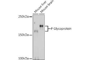Western blot analysis of extracts of various cell lines, using P Glycoprotein Rabbit pAb (ABIN6134228, ABIN6136339, ABIN6136342 and ABIN6215442) at 1:1000 dilution.