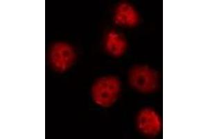 ABIN6275734 staining HepG2 by IF/ICC. (OSR2 anticorps  (Internal Region))