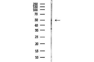 anti-3-Hydroxy-3-Methylglutaryl-CoA Synthase 2 (Mitochondrial) (HMGCS2) antibody