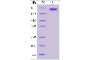 Cynomolgus ACE2, His Tag on SDS-PAGE under reducing (R) condition.