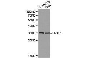 Western Blotting (WB) image for anti-U2 Small Nuclear RNA Auxiliary Factor 1 (U2AF1) antibody (ABIN1875401) (U2AF1 anticorps)