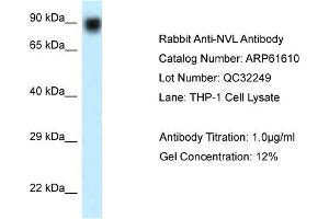 Western Blotting (WB) image for anti-Nuclear VCP-Like (NVL) (N-Term) antibody (ABIN2788850) (NVL anticorps  (N-Term))