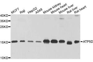 Western blot analysis of extracts of various cell lines, using ATP5D antibody. (ATP5F1D anticorps)