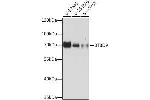 Western blot analysis of extracts of various cell lines, using BTBD9 Rabbit pAb (ABIN7265955) at 1:1000 dilution.