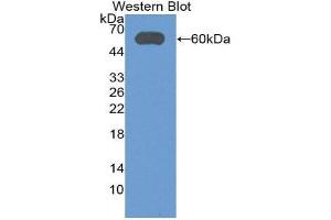 Western Blotting (WB) image for anti-Aldehyde Dehydrogenase 7 Family, Member A1 (ALDH7A1) (AA 1-539) antibody (ABIN3201764) (ALDH7A1 anticorps  (AA 1-539))
