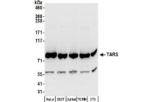 Western Blotting (WB) image for anti-threonyl-tRNA Synthetase (TARS) (AA 673-723) antibody (ABIN7450802)