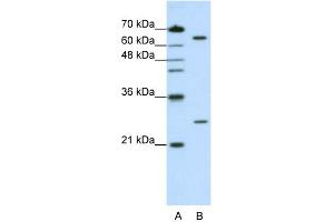 WB Suggested Anti-NUDT21 Antibody Titration:  1. (NUDT21 anticorps  (N-Term))